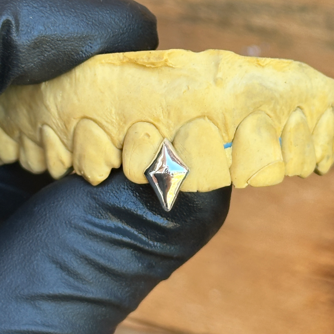 silver star cap grillz on a dental teeth model