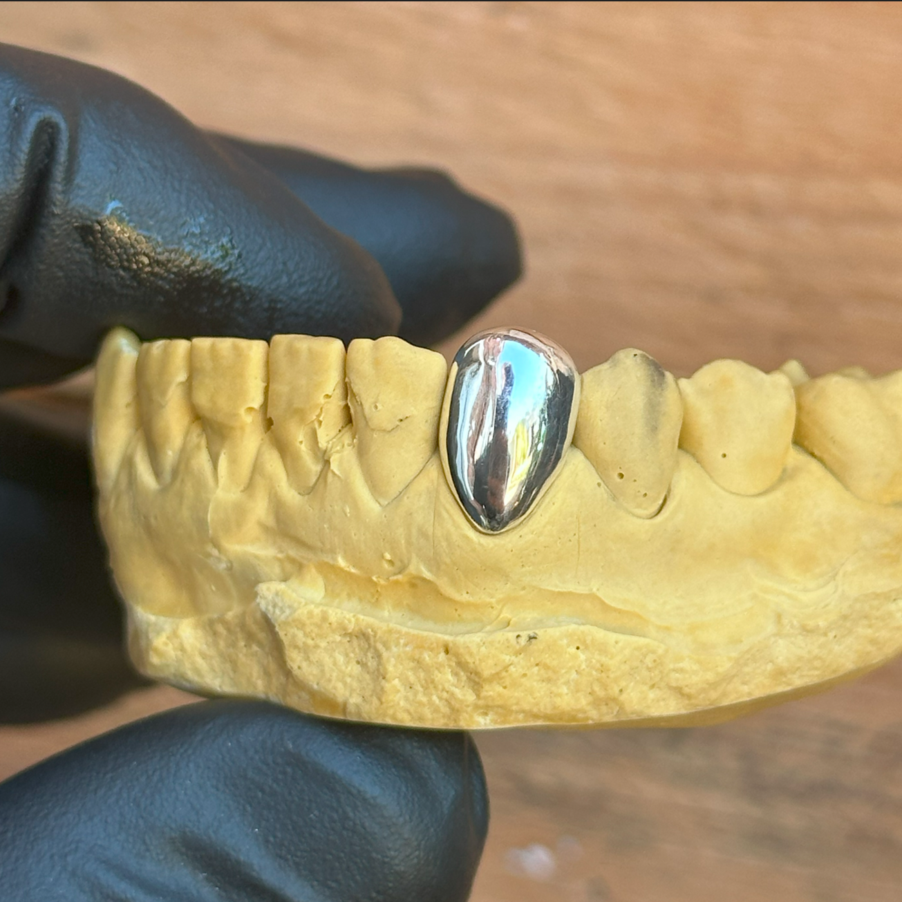 Dental model with a silver grillz cap held by a gloved hand on a wooden surface
